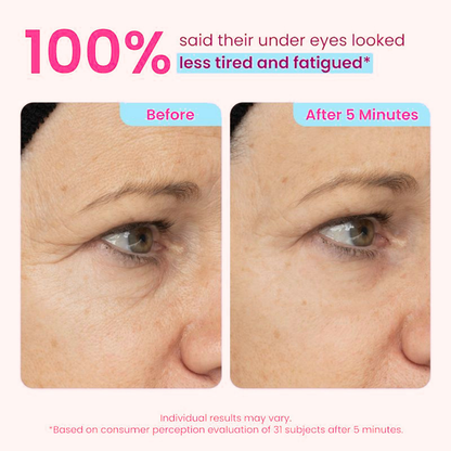 👀 Slimoly® Instant Eye Tightening Gel