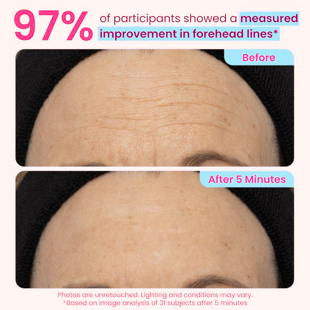 👀 Slimoly® Instant Eye Tightening Gel