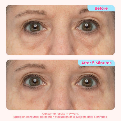 👀 Slimoly® Instant Eye Tightening Gel