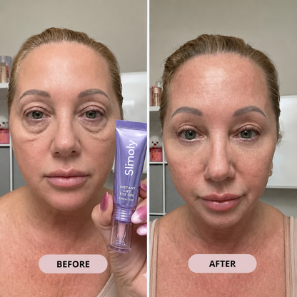 👀 Slimoly® Instant Eye Tightening Gel