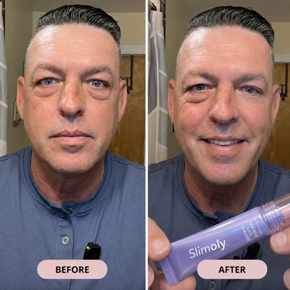 👀 Slimoly® Instant Eye Tightening Gel
